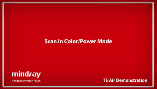 Mindray TE Air Tutorial - Scan in Color/Power Mode