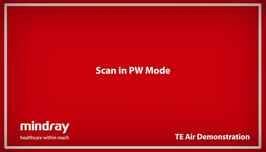 Mindray TE Air Tutorial - Scan in Pulse Wave (PW) Mode